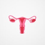 ovary preservation after hysterectomy